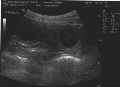 Ultraschalluntersuchung Uterus Olga von Rekkas Holzhütte